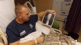 Kurt Fowler looks at an X-ray of his ankle as he sits in a hospital bed at Sunrise Hospital & Medical Center. Fowler, a firefighter from Arizona, got shot in the ankle and said he expects to be out of work for months as he recovers. (Anna Gorman/KHN)