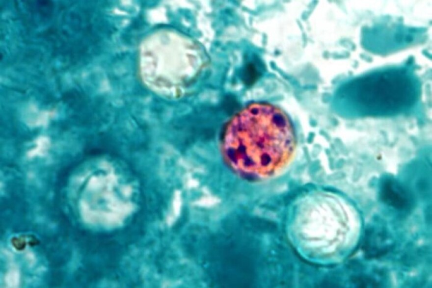 This photo shows four Cyclospora "oocysts" under a microscope. A Kansas woman is suing Taco Bell after she allegedly contracted the parasite from food there.