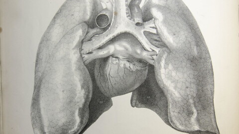 Specialized cells inside the heart can't switch jobs to start dividing if they're injured.