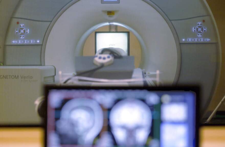 A brain-scanning MRI machine is seen in Pittsburgh, Nov. 26, 2014. (Keith Srakocic/AP)
