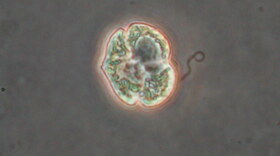 A single-cell of the algae species Karenia brevis, which causes Florida red tide.