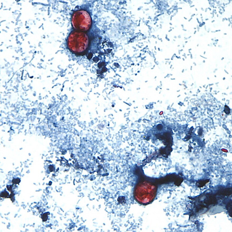 A microscope photo Cyclospora cayetanensis oocysts found in a fresh stool sample 