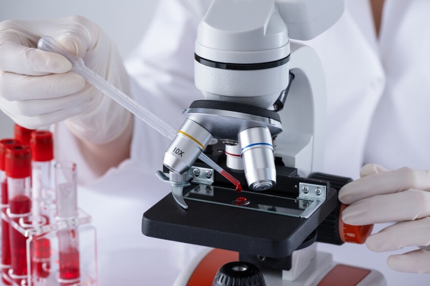 A scientist is using a microscope to examine a blood sample. Checking for hsCRP requires only a blood test.