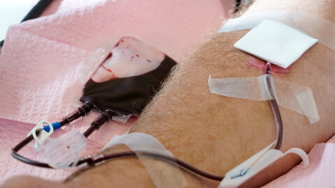 Tubes direct blood from a donor into a bag.