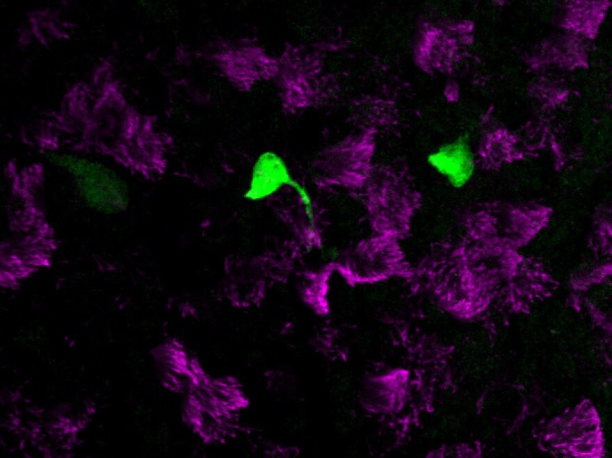 Newly identified, rare pulmonary ionocytes (green) dot the landscape of ciliated cells (magenta) of the mouse lung airway lining.