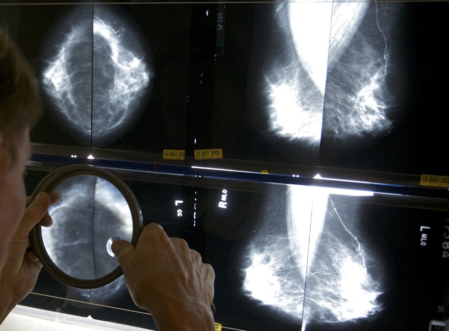 Health insurance companies in Pennsylvania will soon be required to pick up the tab on genetic testing and supplemental screenings for women with a high chance of breast cancer.
