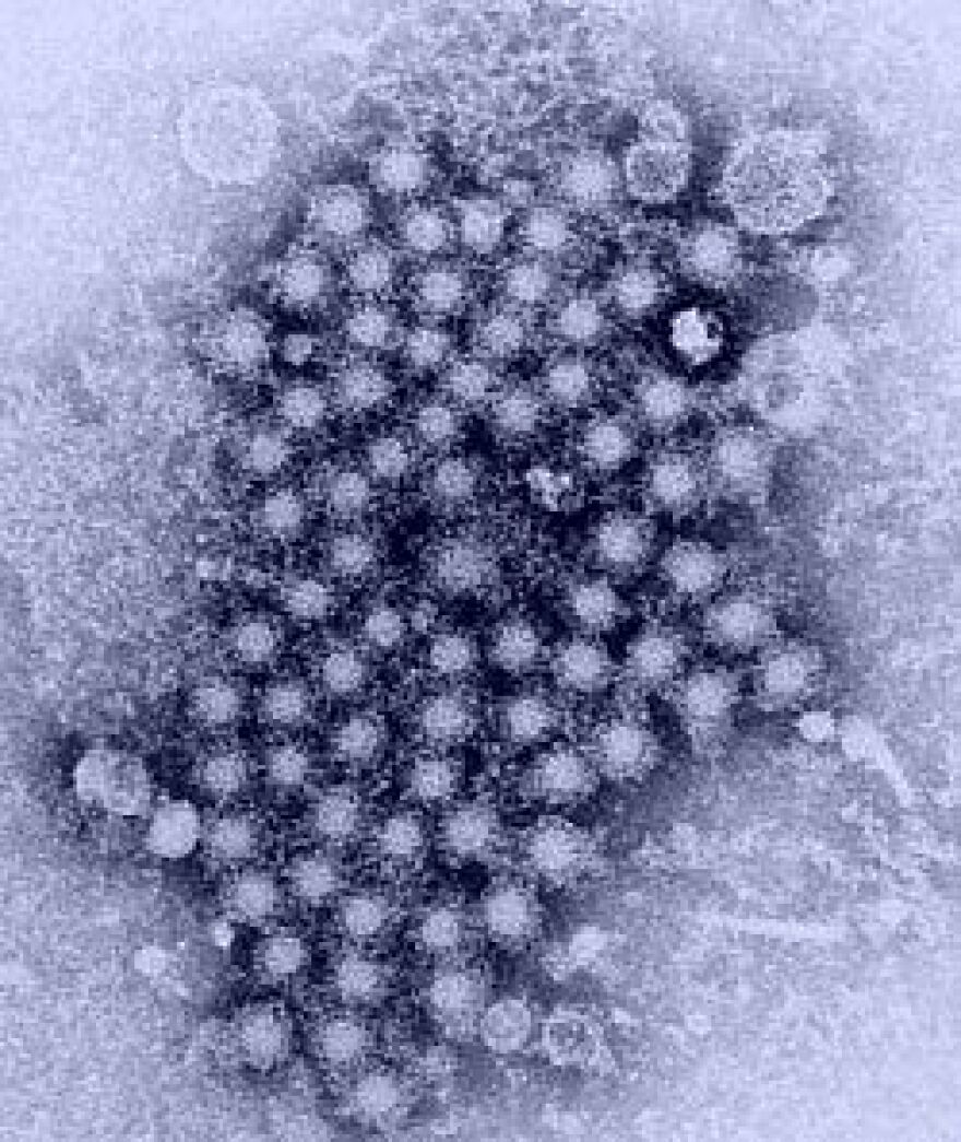 A cluster of hepatitis viruses, as seen through a transmission electron microscope.