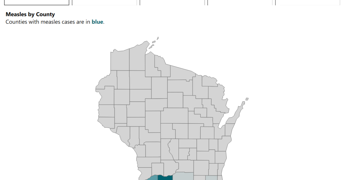 State health officials urge parents to check kids’ vaccination status as measles outbreaking in Wisconsin tops 100