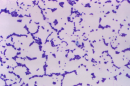 A view of the enterococcus bacteria under a high-powered microscope