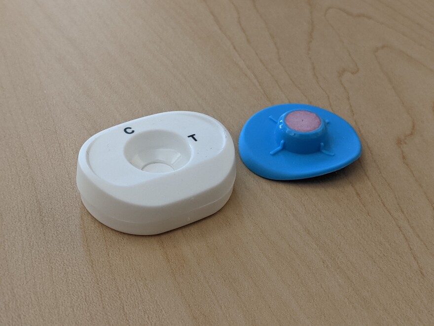 An antibody test developed by John Alderete can quickly and accurately detect someone who is positive for trichomoniasis, or "trich." Trichomoniasis is the most common non-viral STD in the world, but often goes undetected and untested in STD screening panels. Photo by Rachel Sun
