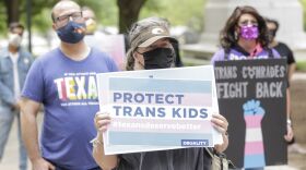 Erich Schlegel/AP Images for Human Rights Campaign