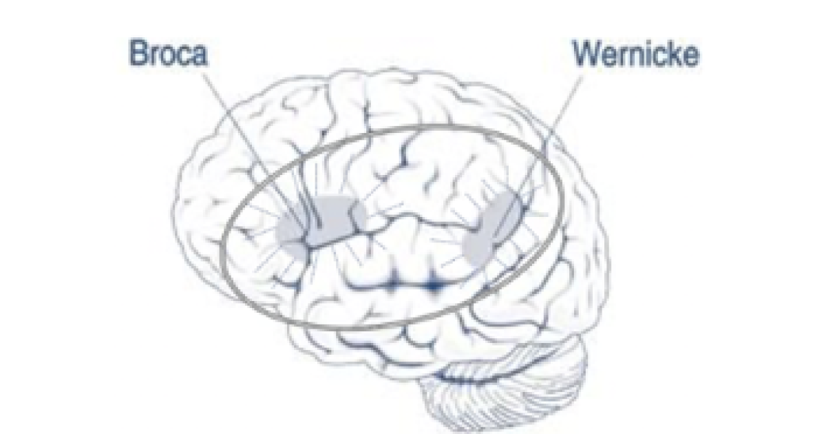 Health Sciences outreach program helps amplify the voices of people with aphasia
