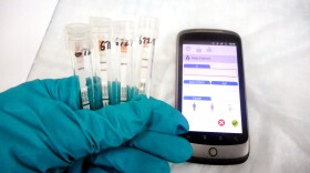 The rapid Ebola test from Corgenix Medical Corporation is small and easy to use. But because it involves blood, health workers would still need to run the test at a lab to stay safe.