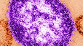 This undated image made available by the Centers for Disease Control and Prevention on Feb. 4, 2015 shows an electron microscope image of a measles virus particle, center. (Cynthia Goldsmith/Centers for Disease Control and Prevention via AP)