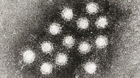 This cropped image shows an electron micrograph of the Hepatitis A virus (HAV).
