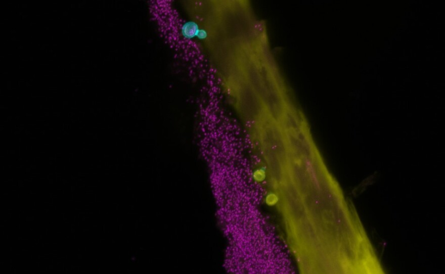 Bacteria (magenta) and fungi (cyan) on a human hair (yellow).