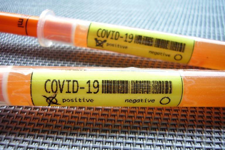 A COVID test.