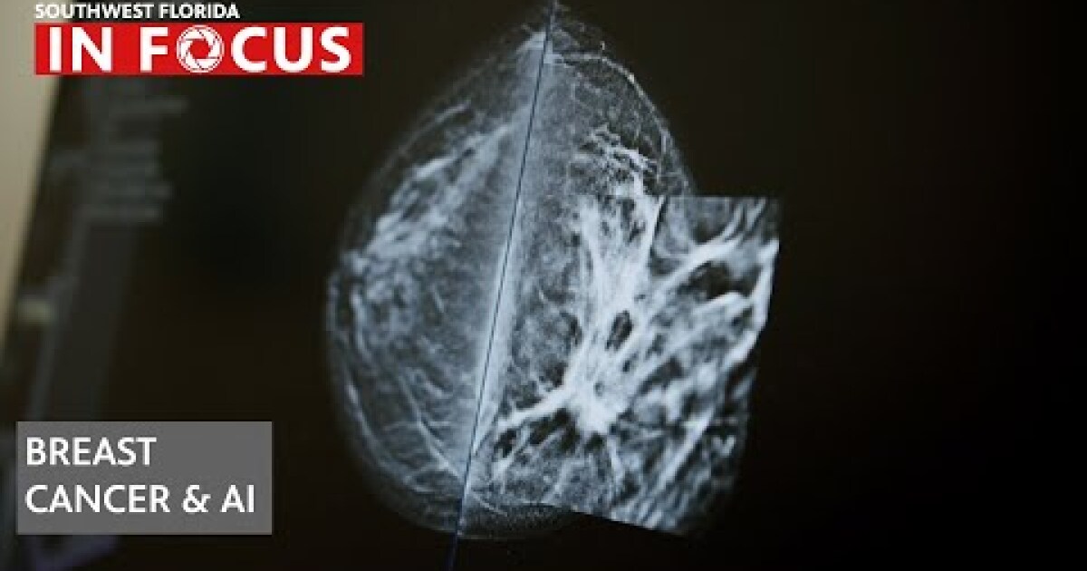 Artificial Intelligence joins the battle against breast cancer