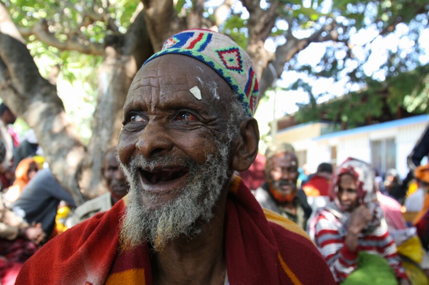 Ahmed Ali, the day after his cataract surgery. He has just had the bandages removed from his eyes and can see again. Ali, 75, was blind for 5 years.