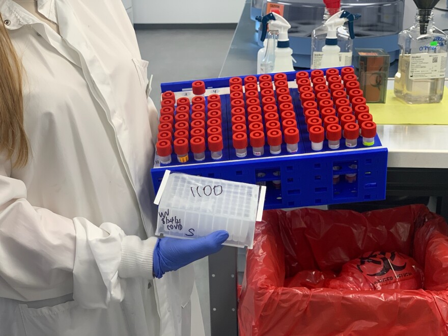 An employee of Reditus Laboratories, 200 Enterprise Drive, in Pekin, holds a tray of COVID-19 test samples.