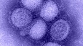 Image of the H1N1 virus.