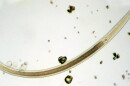Vinegar eels are actually small creatures known as nematodes, like this one shown above.