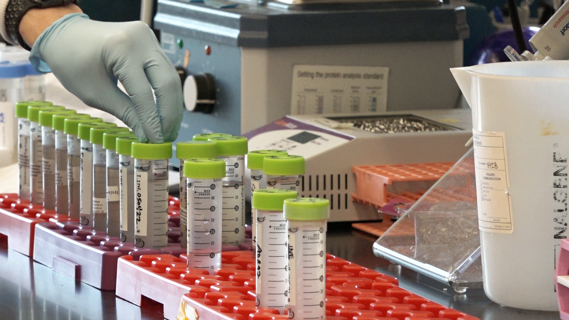Why scientists are looking for clues about coronavirus variants in wastewater - Vimarsana News