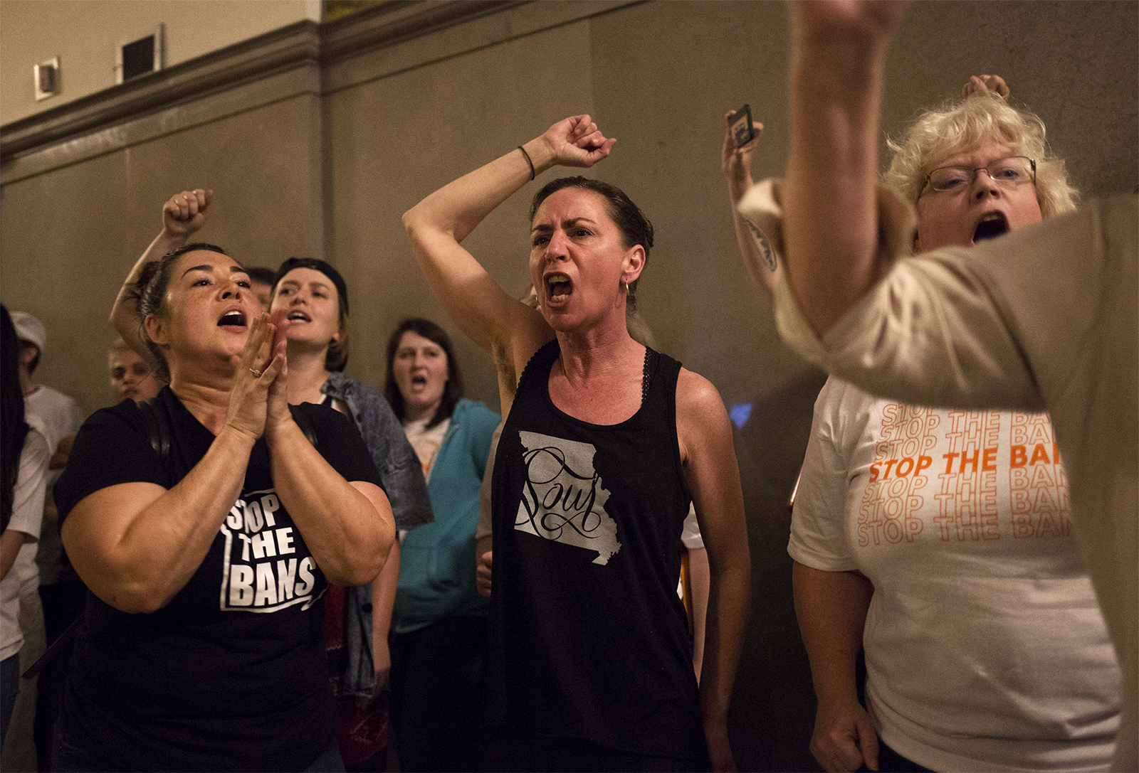 Supreme Court decision could mean near total abortion ban in Missouri - Vimarsana News