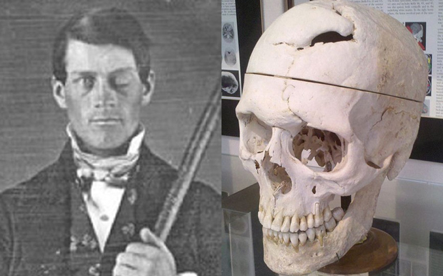 Phineas Gage Phineas Gage Poster Print Noveltees
